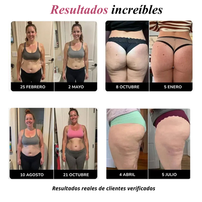 Leggins anticelulíticos 3D